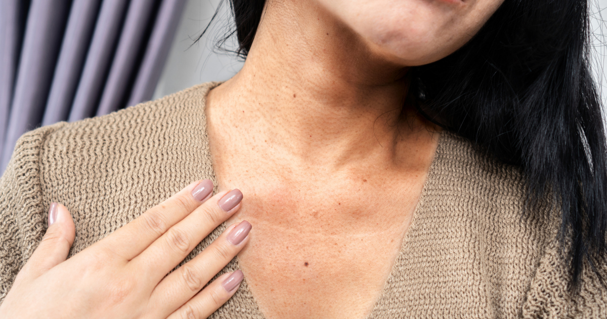 Manchas Escuras no Corpo: Por Que Aparecem nas Dobras e Como Clarear